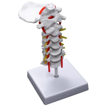 Vratnega Vretenca Arteria Hrbtenice Hrbtenični Živci Anatomski Model Anatomija za Znanost Razredu Študija Prikaz Model Poučevanja